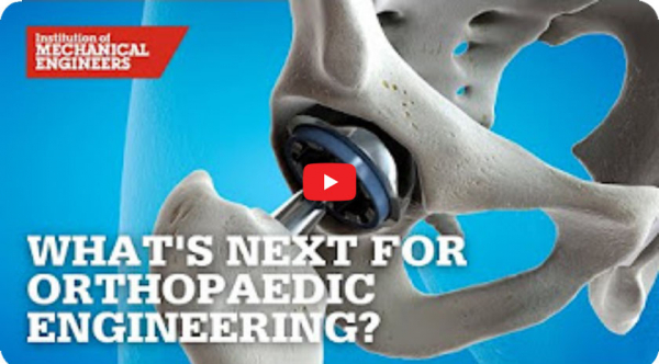 What&#039;s Next for Orthopaedic Engineering? Data-driven Approaches - IMechE